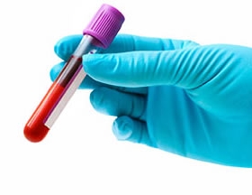 Blood Tests: How to prepare your child