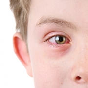 The Many Shades of Pinkeye