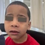 The child’s forehead shows the characteristic maculopapular rash associated with measles.