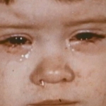 Young child with moderate illness: runny nose, teary eyes caused by measles infection.